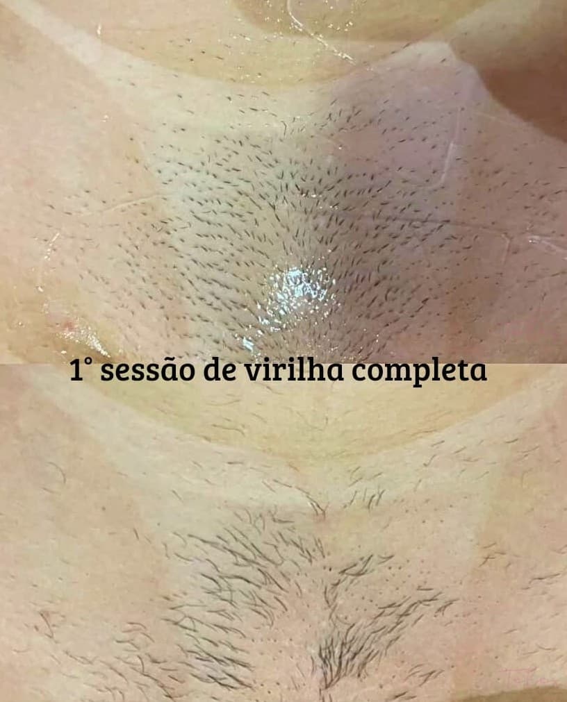 Resultados antes e depois 3