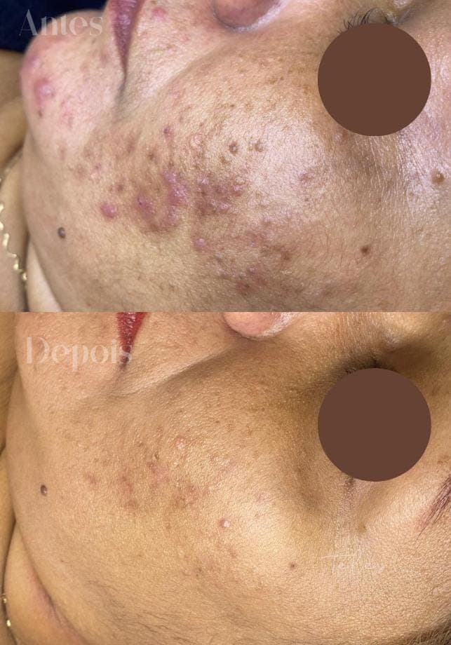 Resultados antes e depois 4