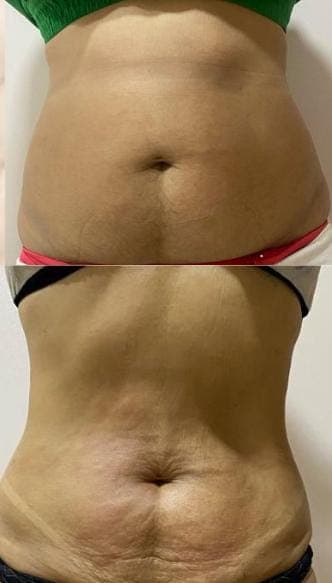 Resultados antes e depois 6