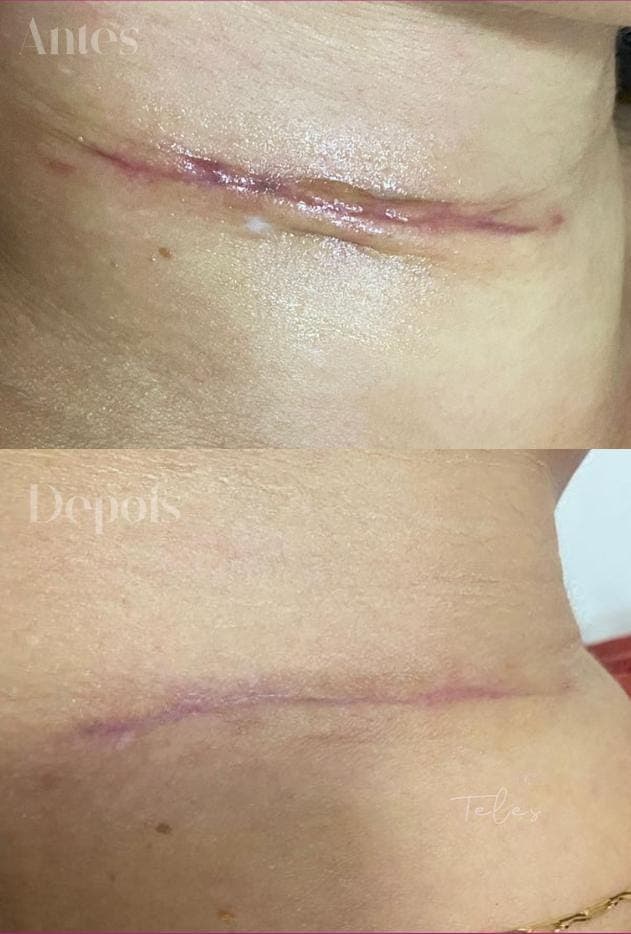 Resultados antes e depois 7